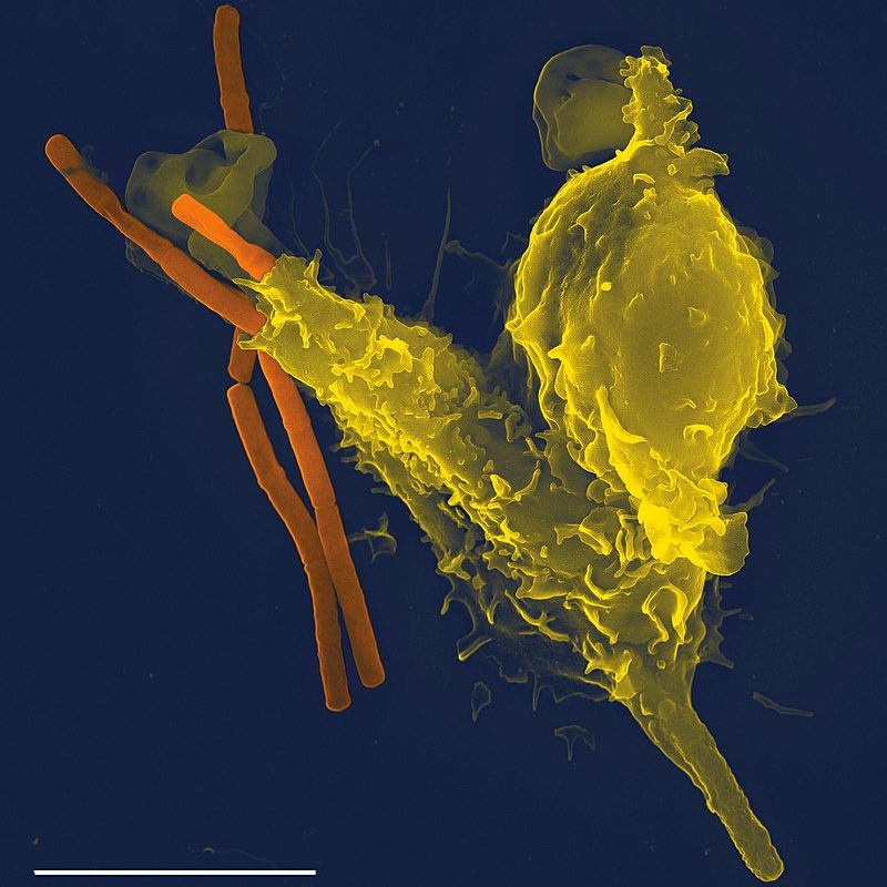 Neutrophil_with_anthrax_copy